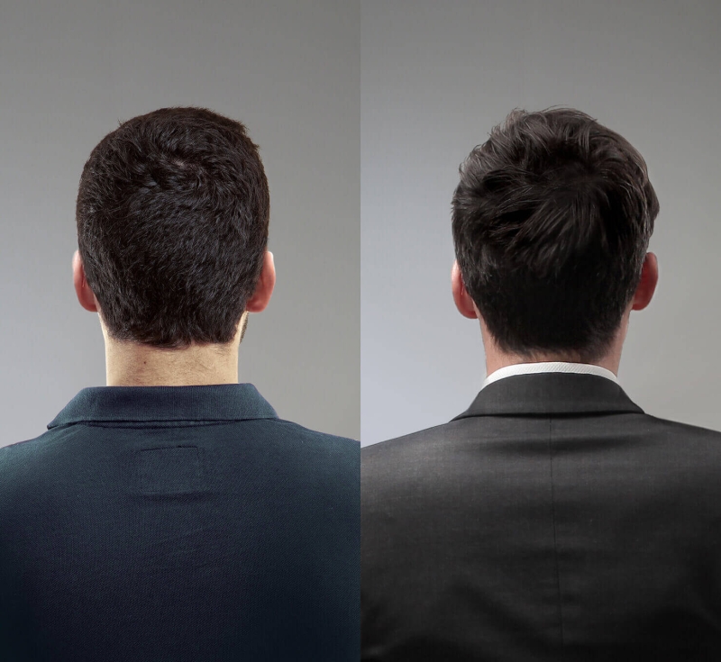 Hairvity Suplement dla mężczyzn Efekty.jpg