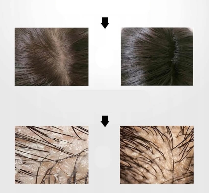 Scalp brush Borovsky Szczotka do pielęgnacji włosów i skóry głowy silver,jpg